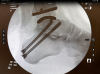 44640015-BF05-457B-844D-18DA18EE291D.png
