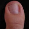 Toe
